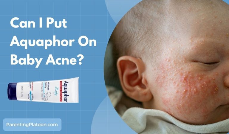 Aquaphor On Baby Acne? (Don’t! – Here’s Why)