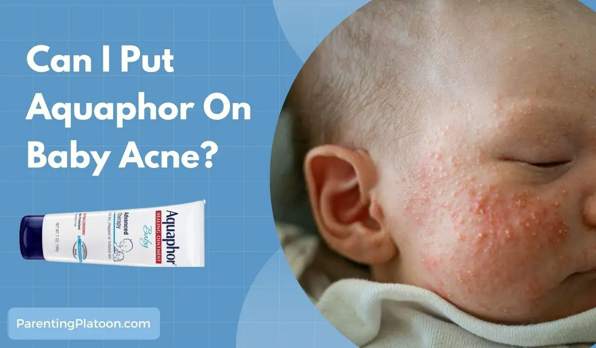 Aquaphor On Baby Acne